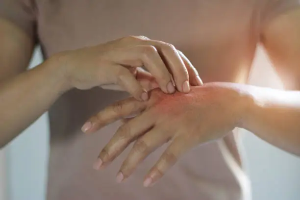 Stressbedingter Hautpilz: Ursachen & Behandlung